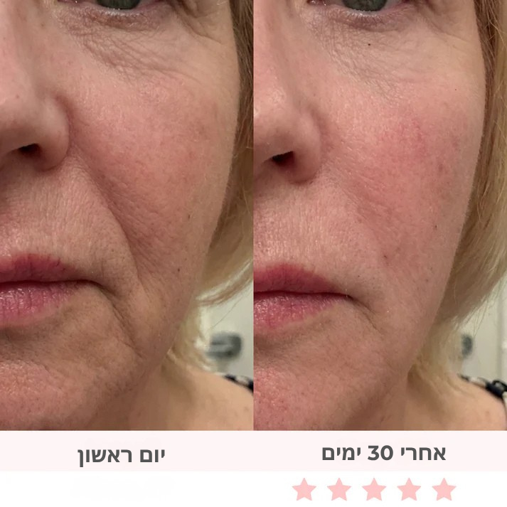 GlowSculpt 7 : מפסל פנים משולב 7 ב-1 בטכנולוגיית תאורת לד.