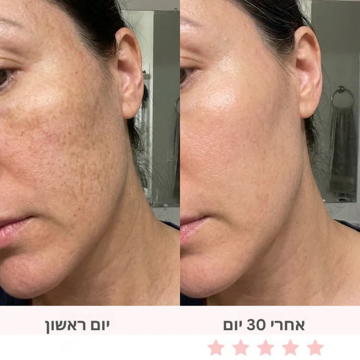 GlowSculpt 7 : מפסל פנים משולב 7 ב-1 בטכנולוגיית תאורת לד.